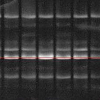 明膠酶譜MMP(2/9)檢測實驗